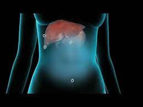 Imagem do procedimento Colecistectomia Videolaparoscópica